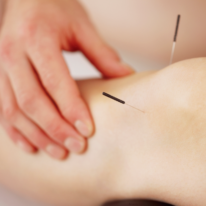 needles stimulating meridians and energy flow